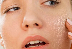 why-skin-dry
