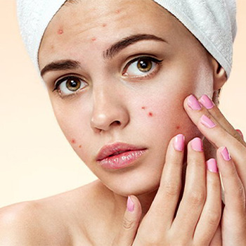 image-skincare-acne-ukr image-skincare-acne-ukr