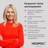 Стік для шиї та зони декольте з пептидами преміум-класу