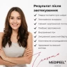 Ліфтинг-крем для шкіри навколо очей з полінуклеотидами та екзосомами